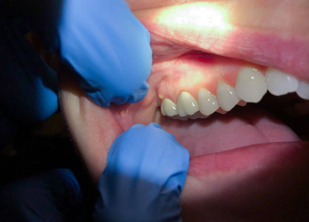 Best Emergency Dental Services Near Me  in Quantico Base, VA
